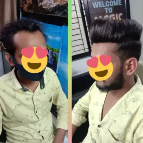 Hair loss can begin gradually, but its i