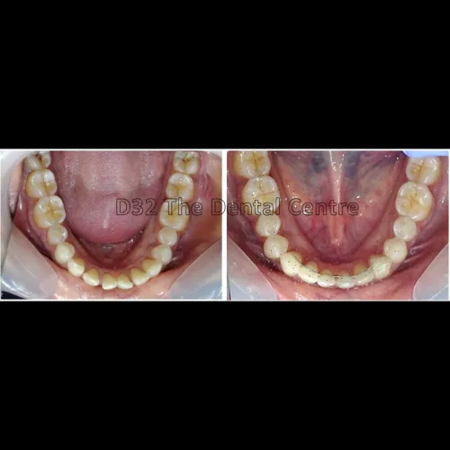 update image