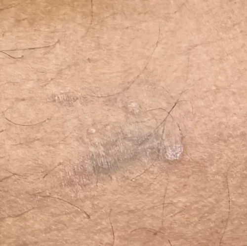 Dr.s.Valarmathi, a skin doctor