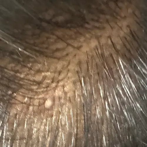 Vibha skin, hair and laser cli
