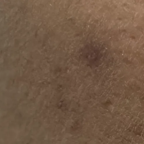 Dr.s.Valarmathi, a skin doctor
