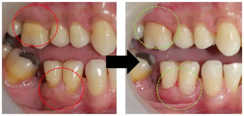 update image