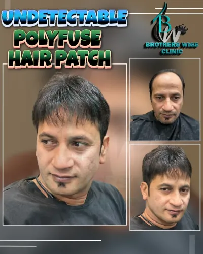 Hair loss can affect confidenc