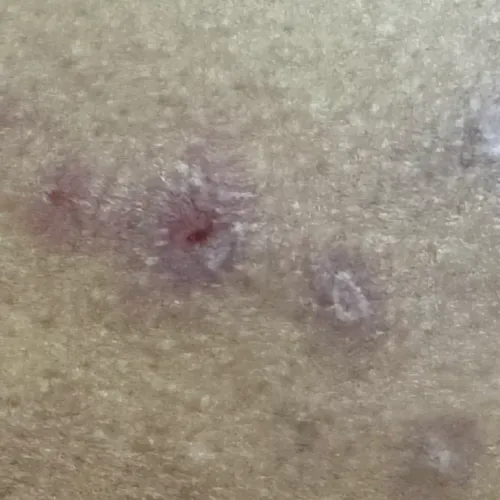 Dr.s.Valarmathi, a skin doctor