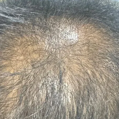 Dr.Valarmathi, a dermatologist