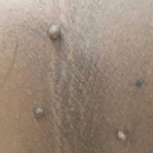Vibha skin, hair and laser cli