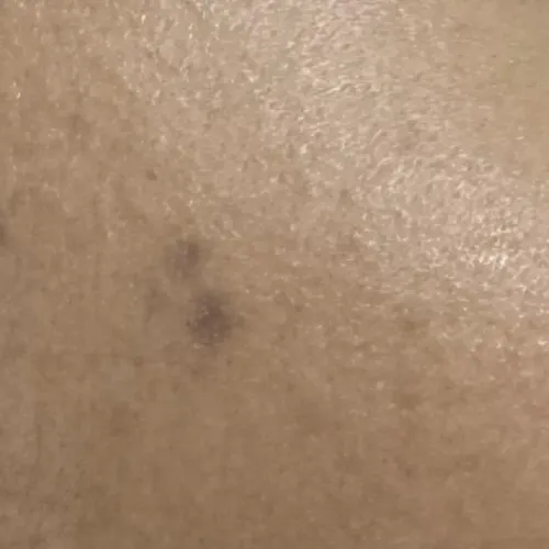 Vibha skin, hair and laser cli