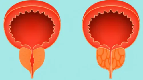 update image