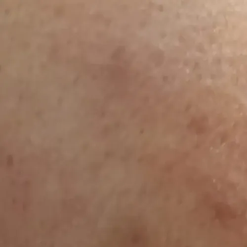 Vibha skin, hair and laser cli