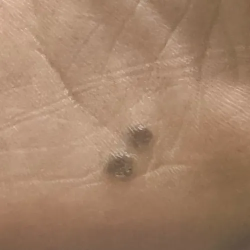 Vibha skin, hair and laser cli