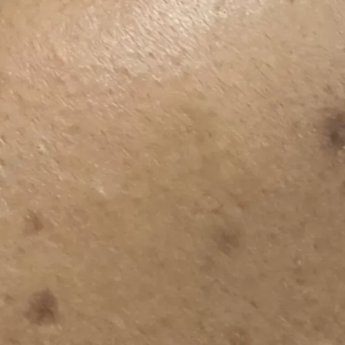Vibha skin, hair and laser cli