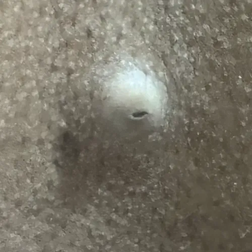 skin diseases doctor near me