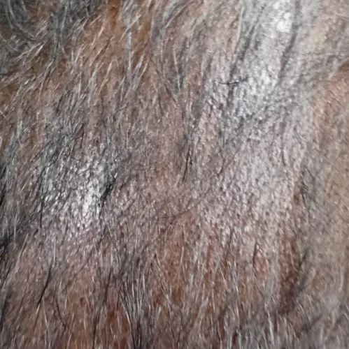 Vibha skin, hair and laser cli