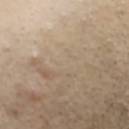 Vibha skin, hair and laser cli