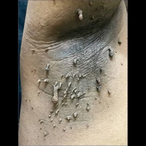 update image