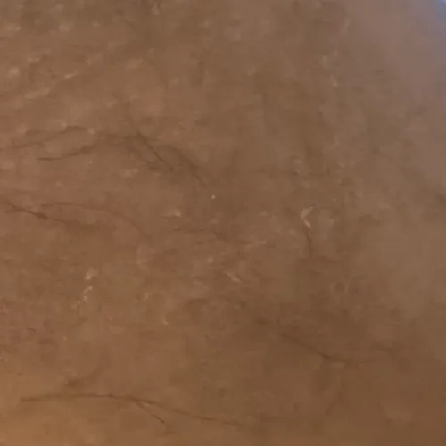 Dr.s.Valarmathi, the best derm