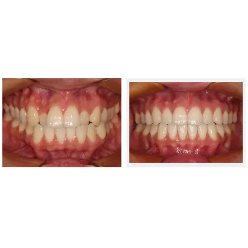 update image