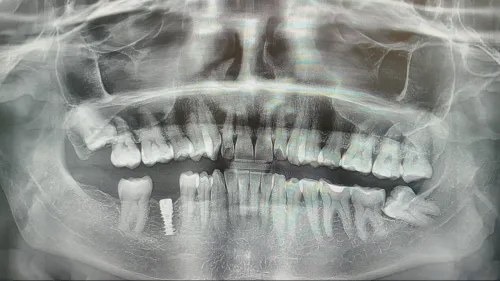 update image