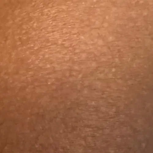 best skin doctor near me