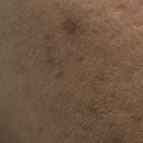 Vibha skin, hair and laser cli