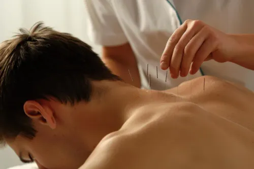 Needling t