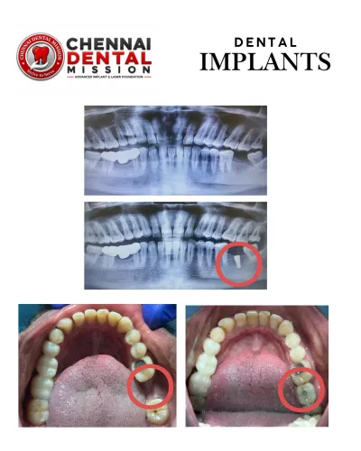update image
