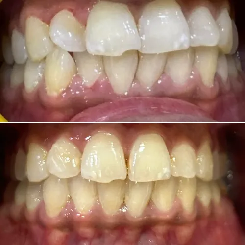 update image