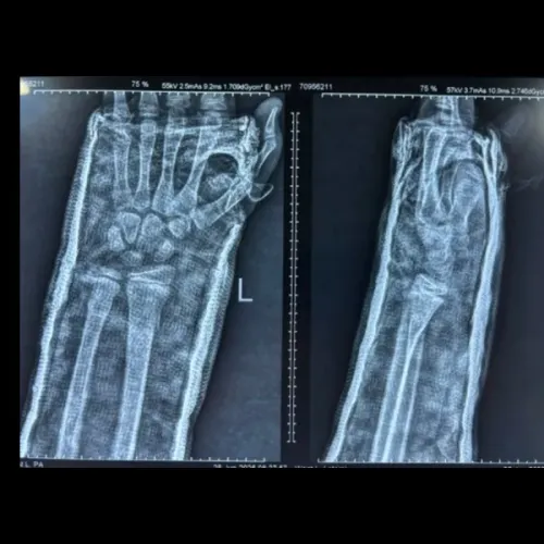 update image