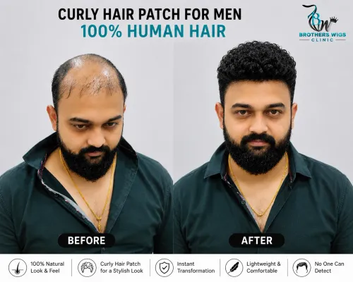 Curly Hair Patch For Men – Ach
