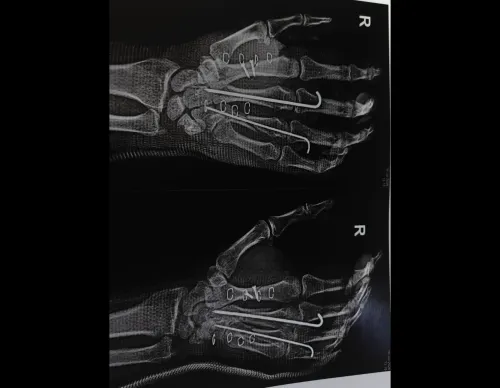 update image