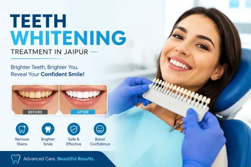 Teeth Whit