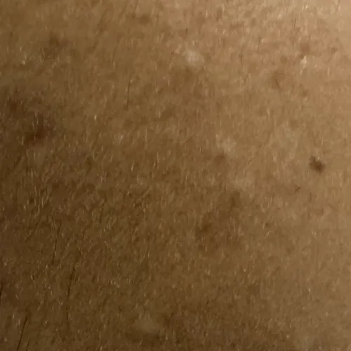 Vibha skin, hair and laser cli