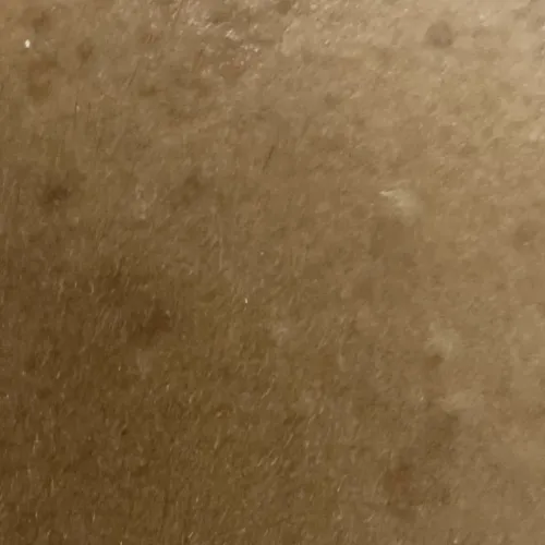 Vibha skin, hair and laser cli