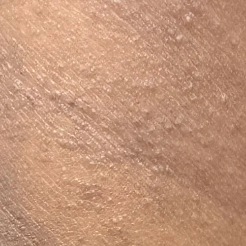 Vibha skin, hair and laser cli