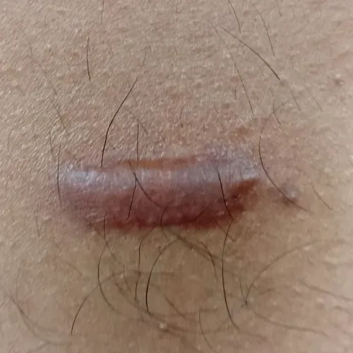 Vibha skin, hair and laser cli