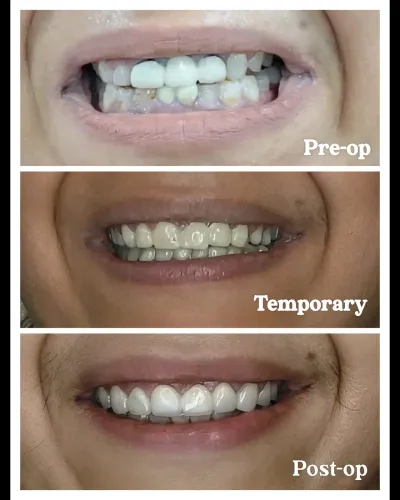 update image