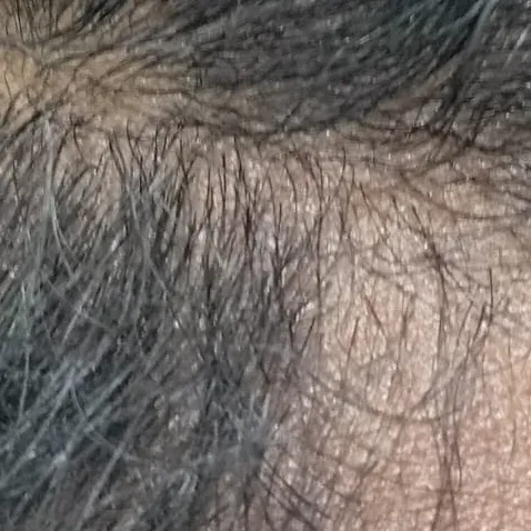Vibha skin