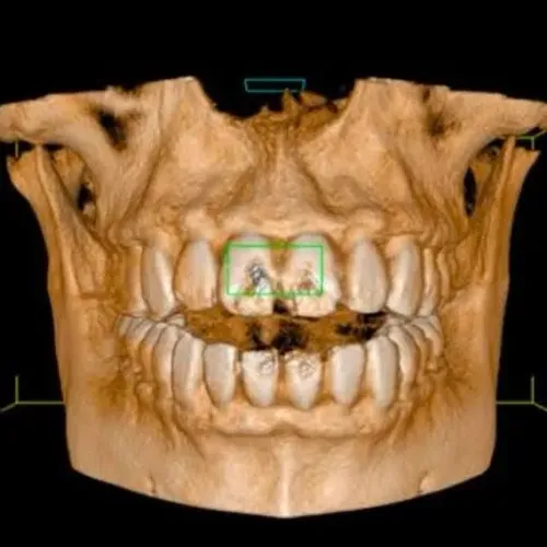 🦷 Looking for the Best CBCT S