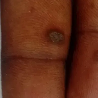 Vibha skin, hair and laser cli