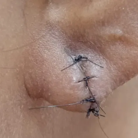 Vibha skin, hair and laser cli