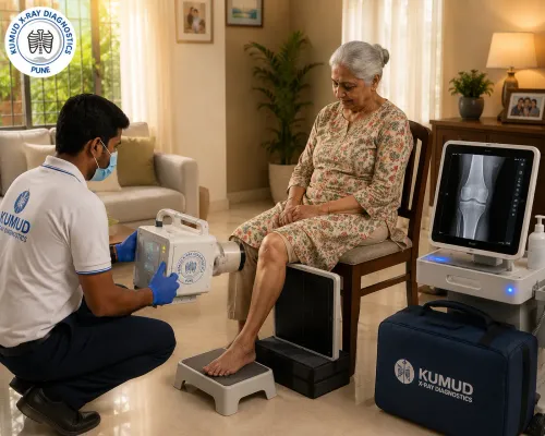 ecg at home pune