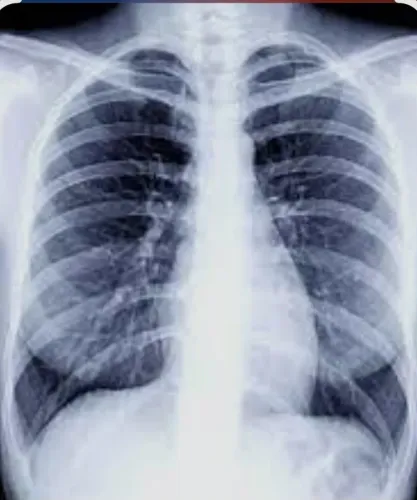 ✨ Best Digital X-Ray in Rohini