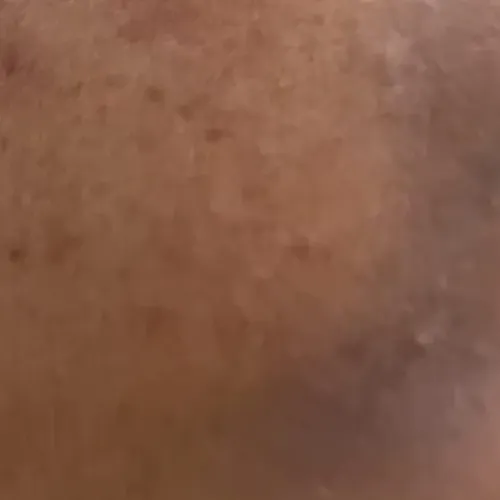 Vibha skin, hair and laser cli