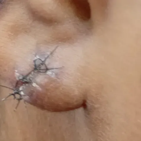 Vibha skin, hair and laser cli