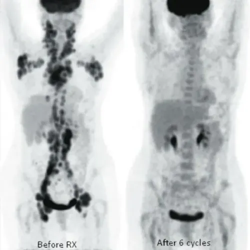 update image