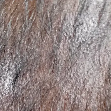 Vibha skin, hair and laser cli