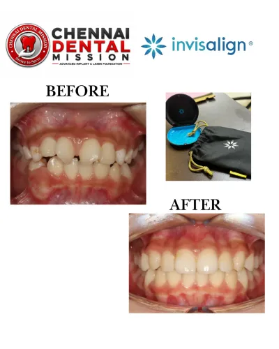 update image