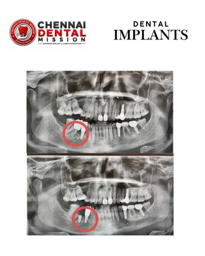 update image