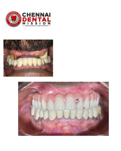update image