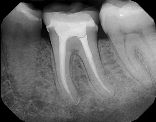 update image